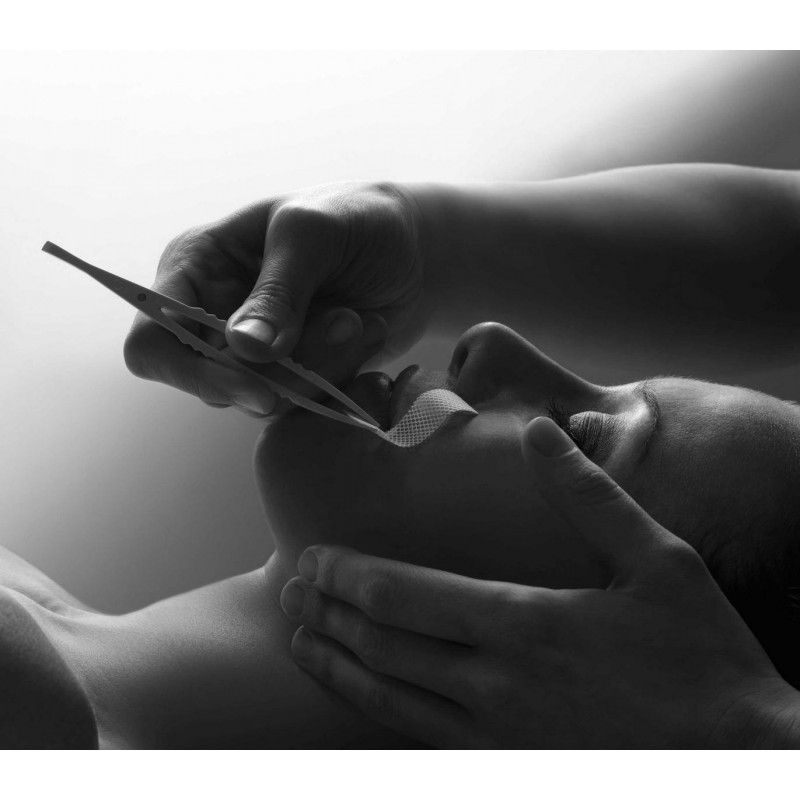 Dárkový poukaz na laserové, estetické, kosmetické omlazovací procedury – náhled 12