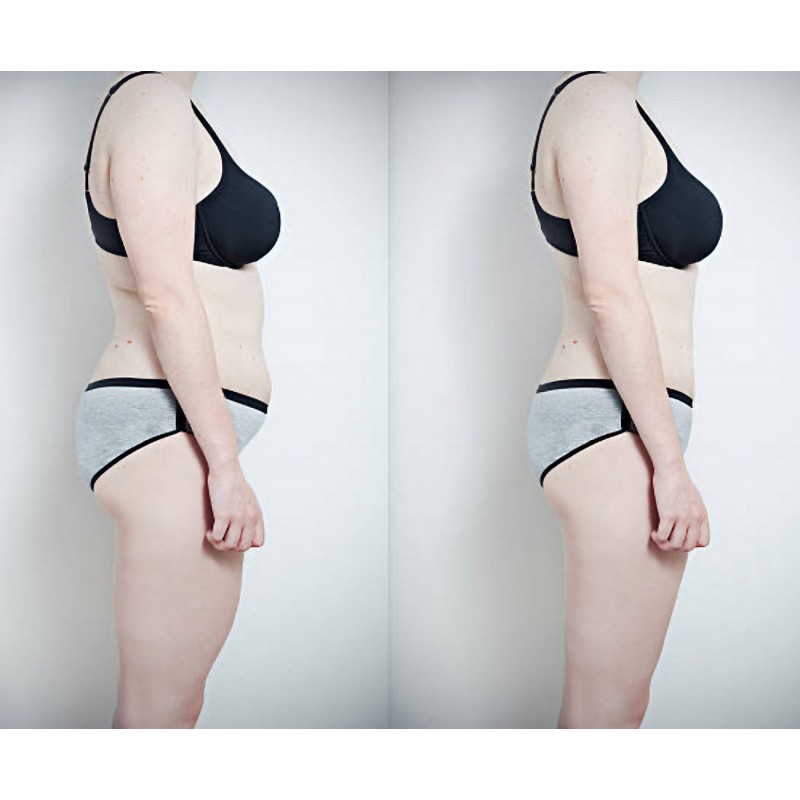 Dárkový poukaz na VIP proměnu těla za 3 měsíce – náhled 7